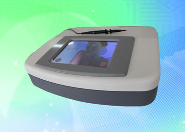 машина удаления вены спайдера 30MHZ для стороны, экрана 150W 8.4Inch